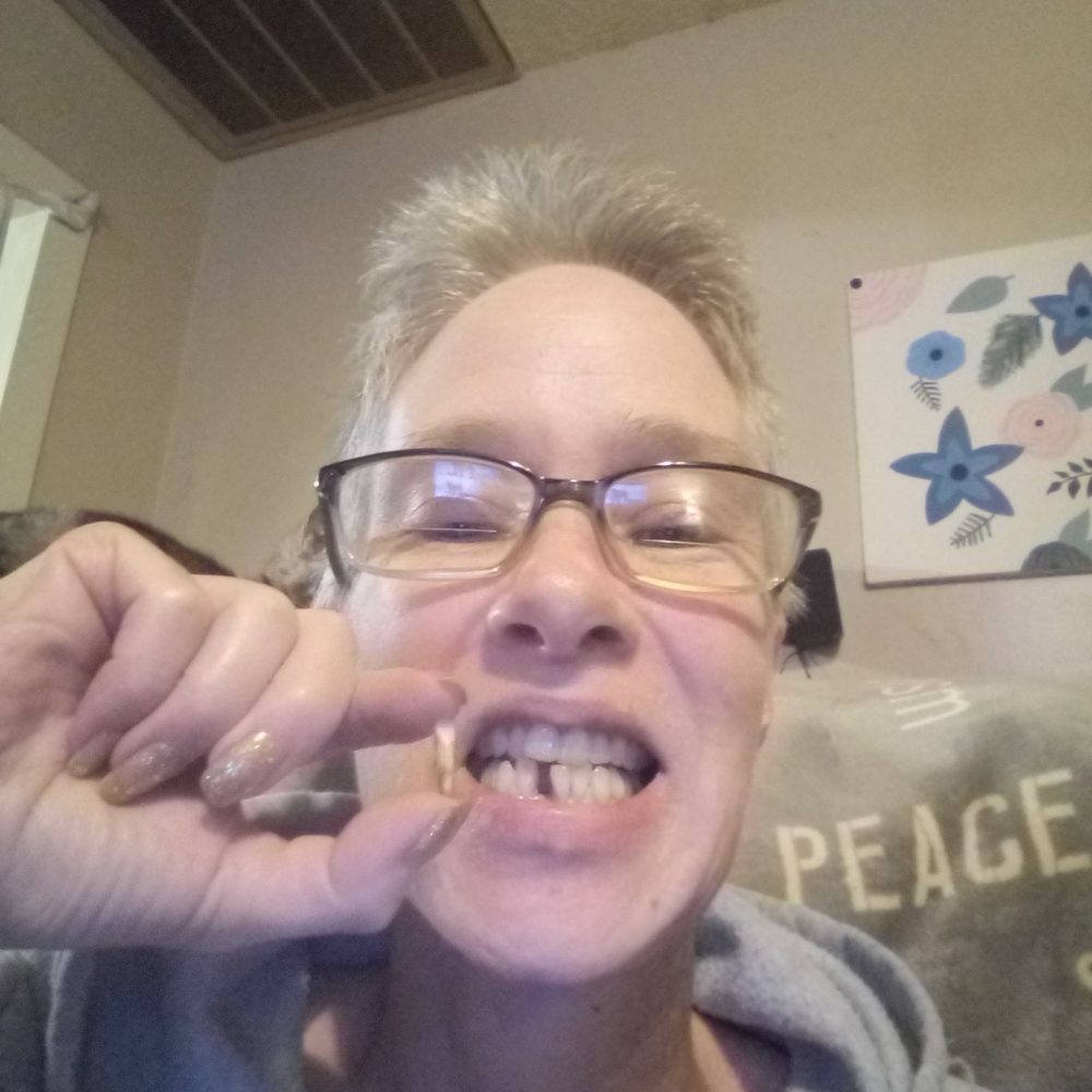 My Cancer Update - Picture 6 of 16